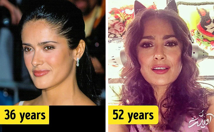 چهره‌های معروفی که هیچ جراحی زیبایی نکرده‌اند